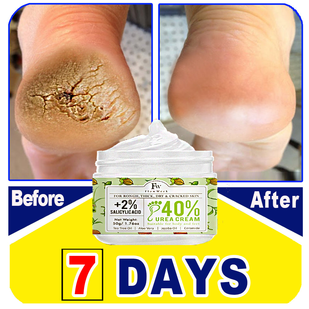 FlowWeek Urea Cream 40% plus salicylic acid 2%, foot cream, suitable for repairing dry and cracked heels, feet, knees, hands and